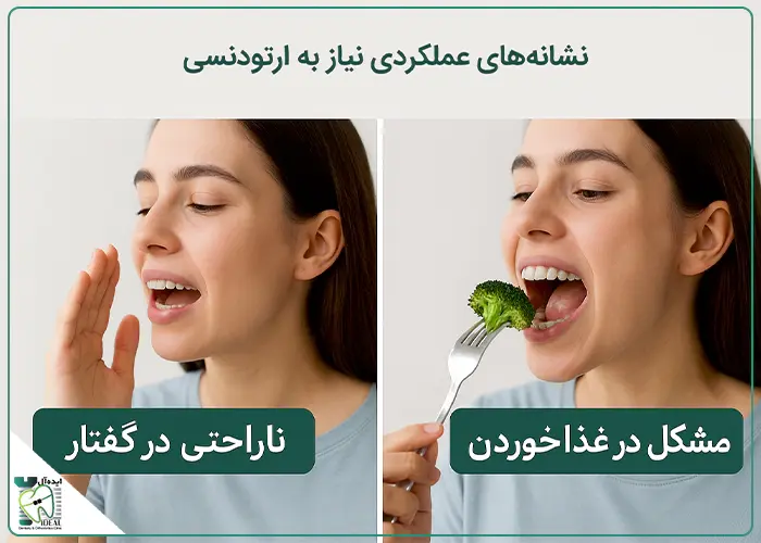 نشانههای عملکردی نیاز به ارتودنسی