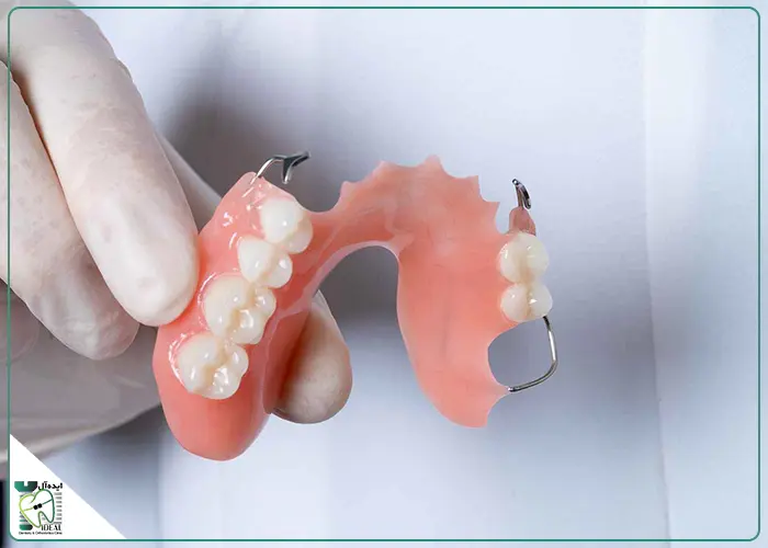 قیمت پروتز پارسیل (تکهای)