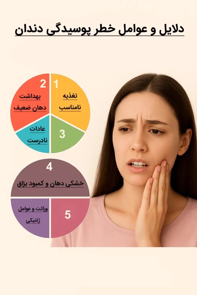 دلایل و عوامل خطر پوسیدگی دندان که باید بشناسید