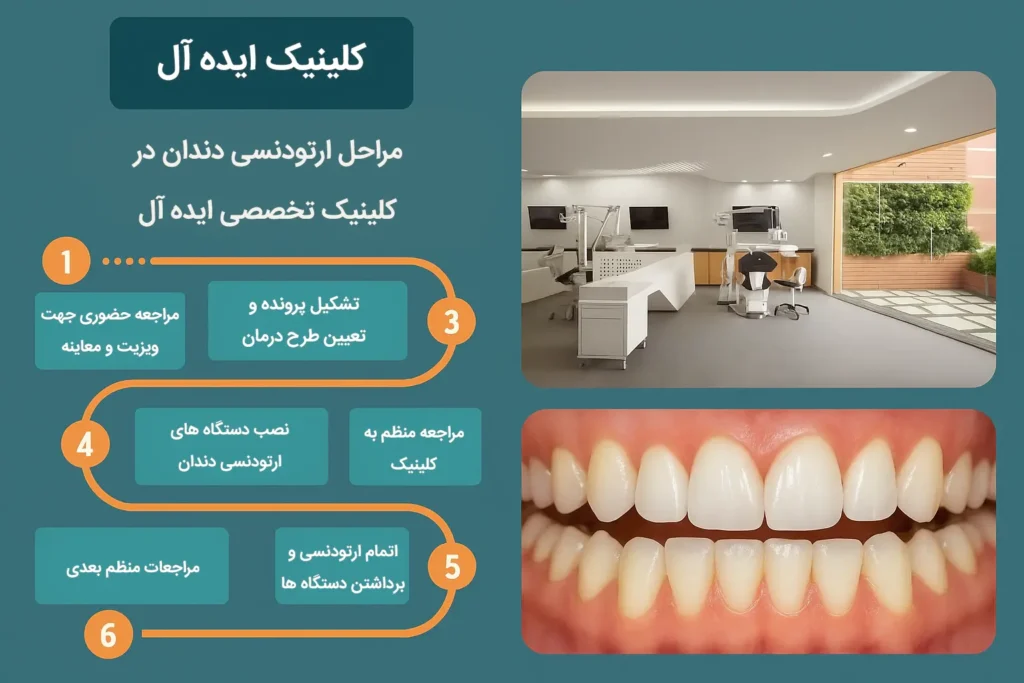 مراحل ارتودنسی دندان در کلینیک تخصصی ایده آل