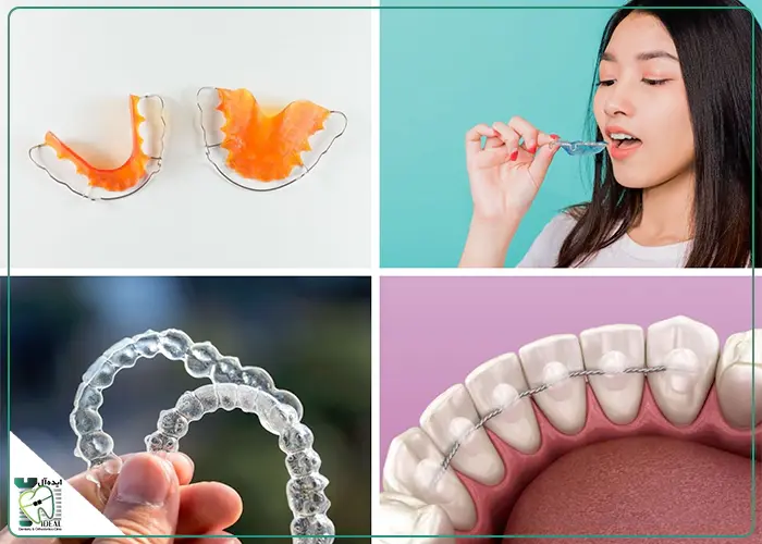اتمام ارتودنسی و برداشتن دستگاه ها
