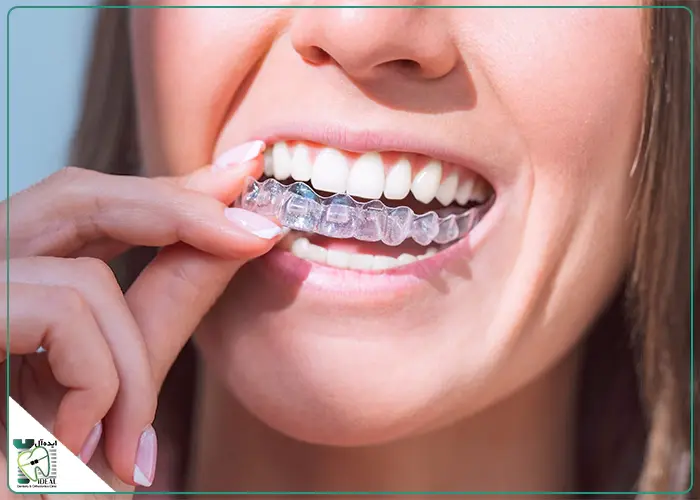 استفاده ناکافی از الاینر (کمتر از ۲۰-۲۲ ساعت)