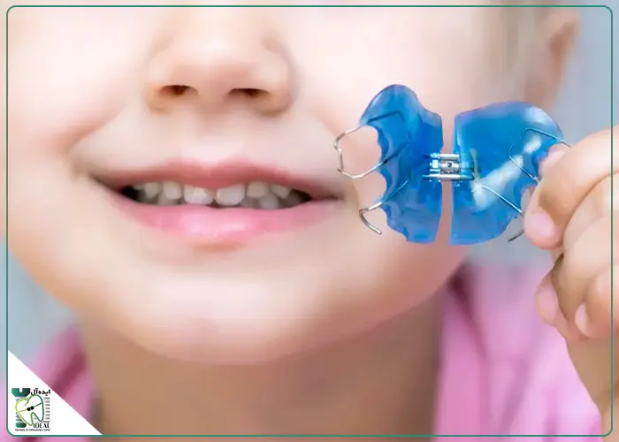 والدین در طول درمان پالاتال اکسپندر چه نکاتی را باید رعایت کنند؟