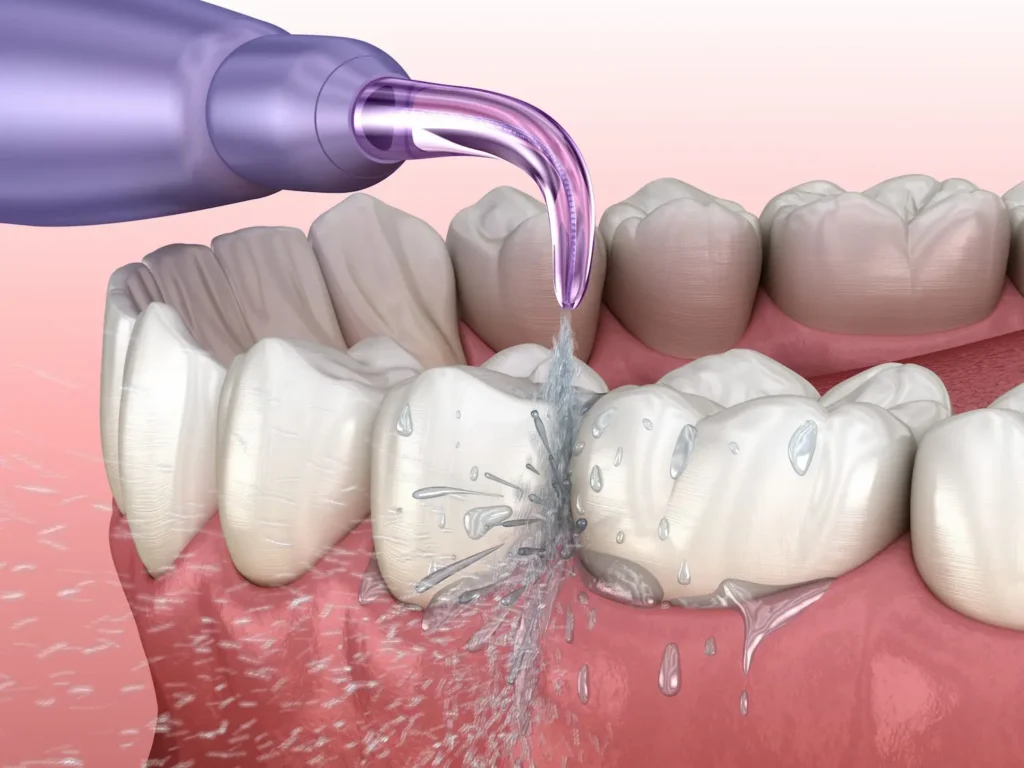 واترفلاسر چیست و چگونه کار میکند؟