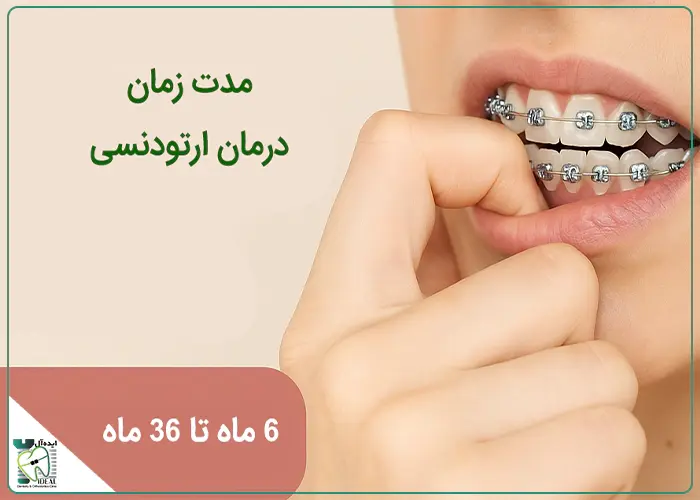 ارتودنسی چقدر طول میکشد؟