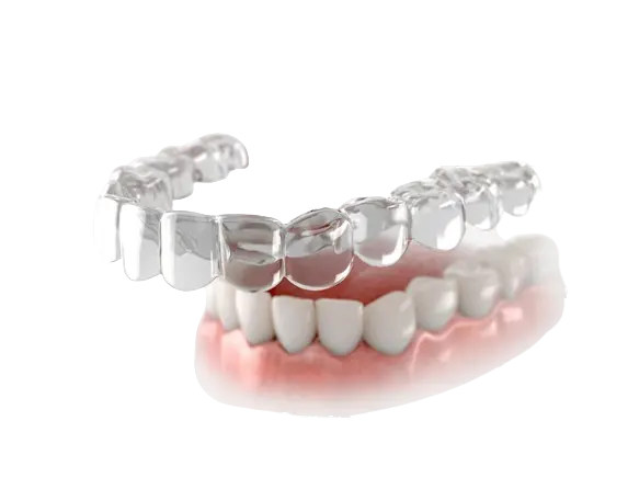 هزینه ارتودنسی نامرئی فک پایین