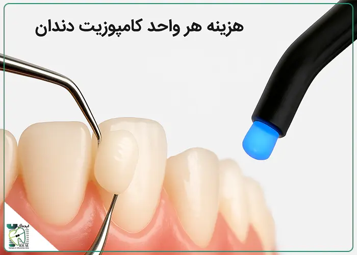 قیمت هر واحد کامپوزیت دندان