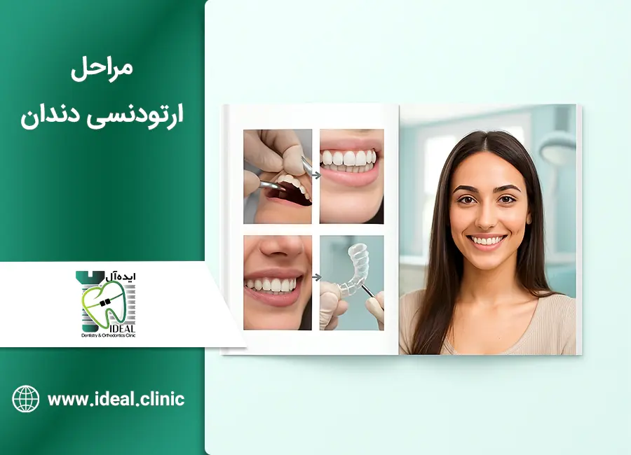 مراحل ارتودنسی دندان