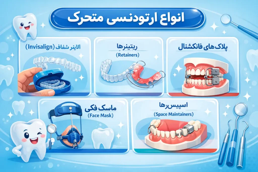 انواع ارتودنسی متحرک