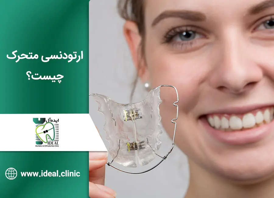 ارتودنسی متحرک چیست؟ همه چیز در مورد آن