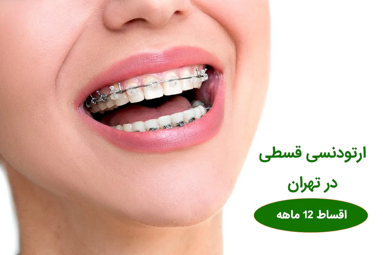 ارتودنسی اقساطی درتهران