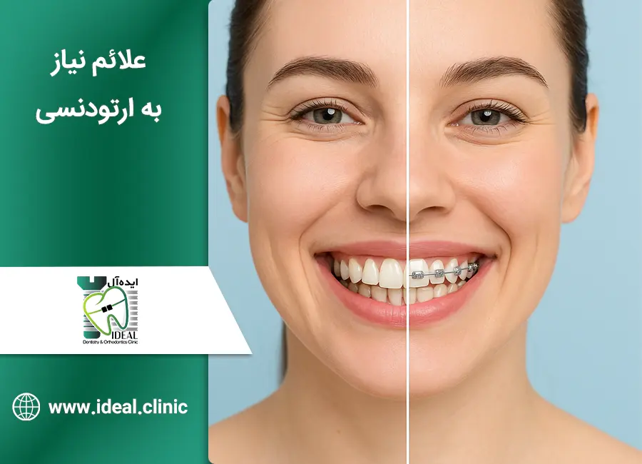 از کجا بفهمم نیاز به ارتودنسی دارم؟