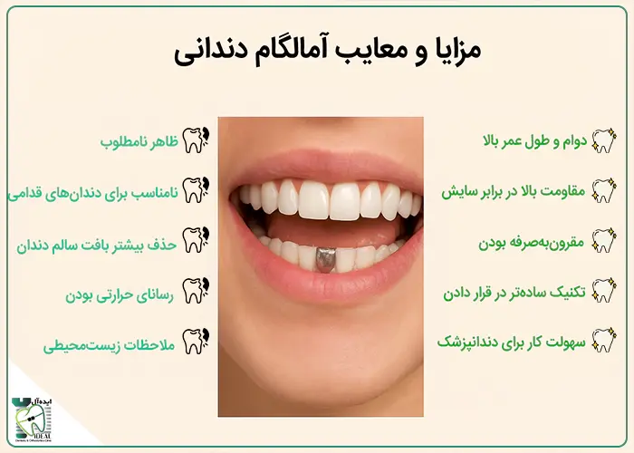 مزایا و معایب آمالگام دندانی