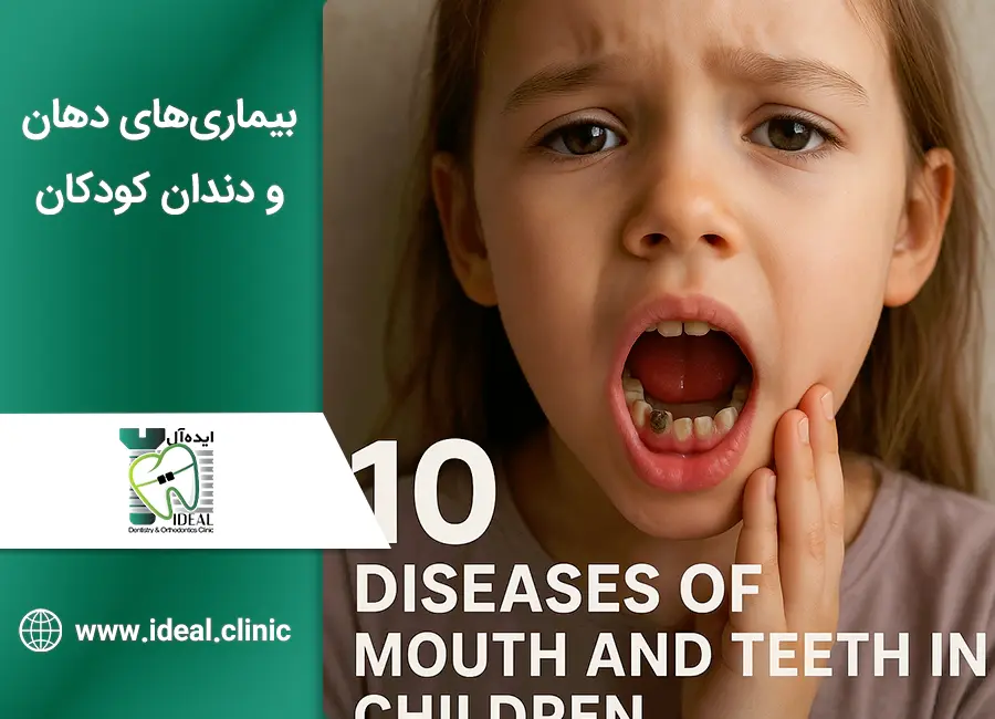 10 تا از شایع ترین بیماریهای دهان و دندان کودکان