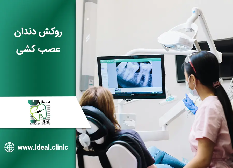 آیا روکش دندان عصب کشی الزامی است؟