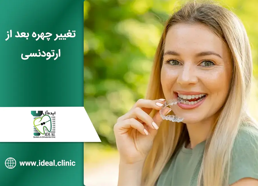 تغییر چهره بعد از ارتودنسی