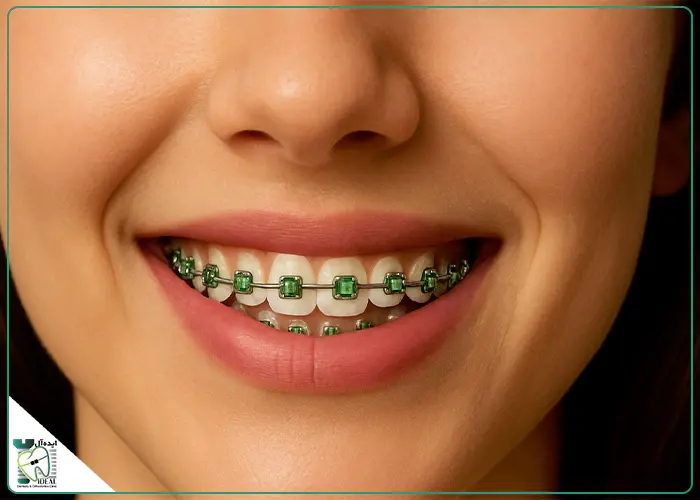 رنگ ارتودنسی سبز