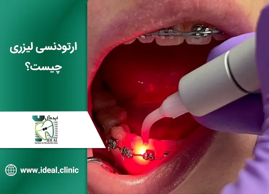 ارتودنسی لیزری چیست؟