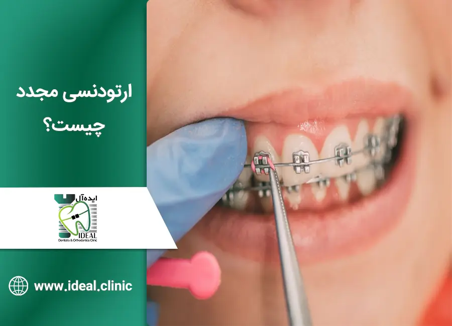 ارتودنسی مجدد چیست؟
