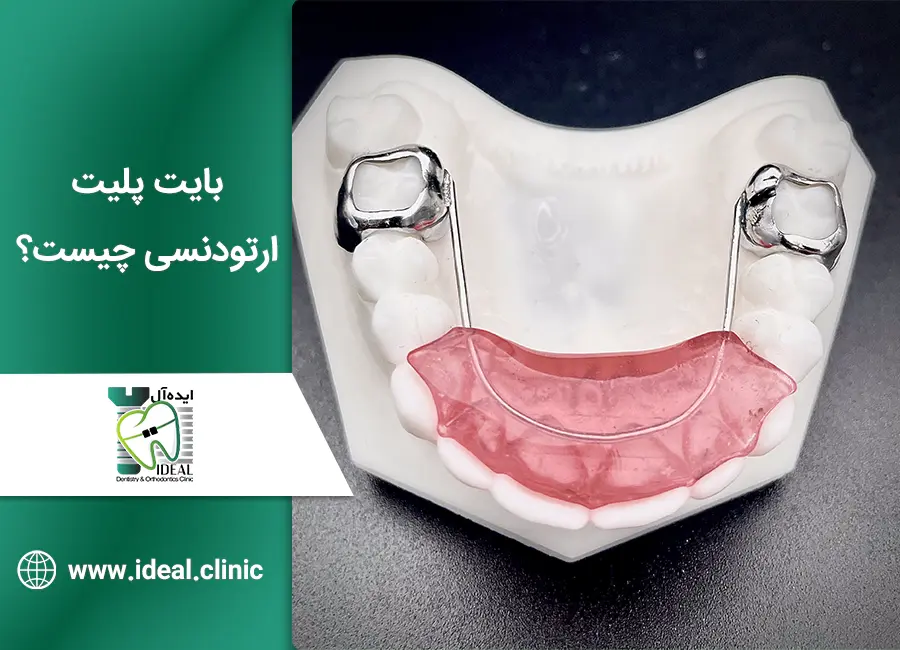 بایت پلیت ارتودنسی چیست؟