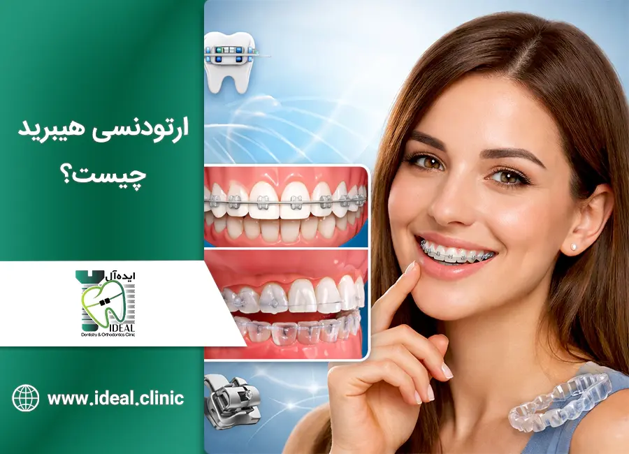 ارتودنسی ترکیبی یا هیبریدی چیست؟