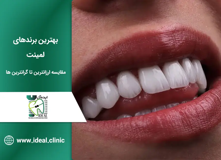 بهترین برندهای لمینت