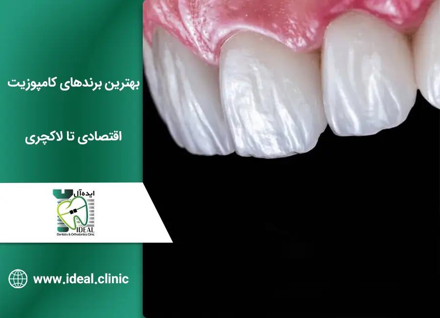 بهترین برندهای کامپوزیت