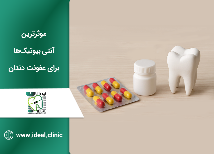 چرک خشک کن قوی برای عفونت دندان
