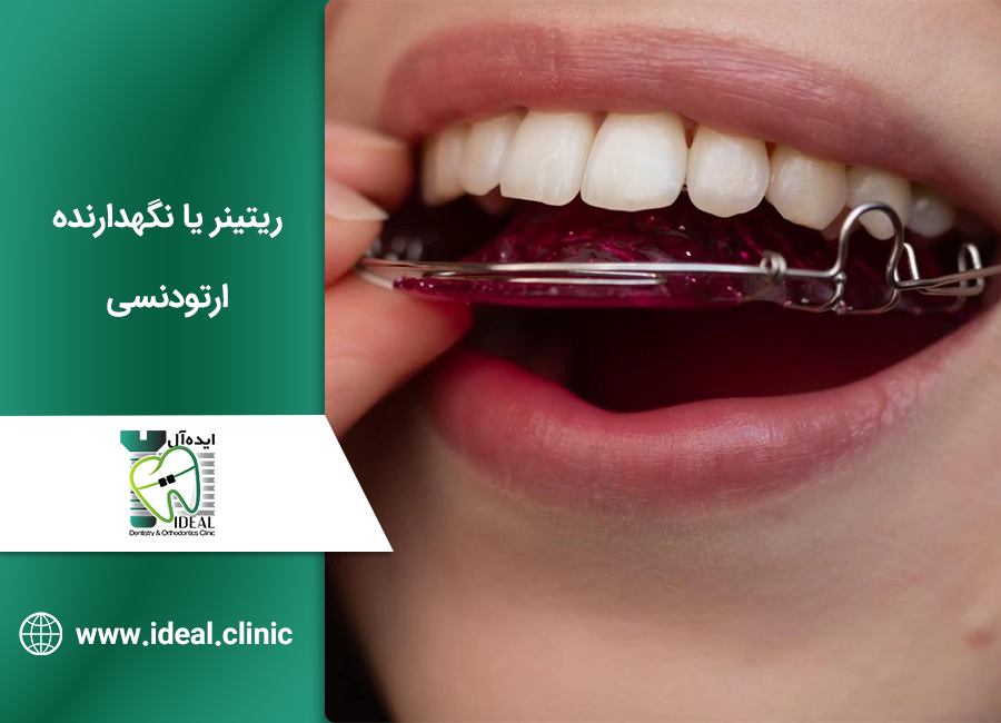 ریتینر یا نگهدارنده ارتودنسی