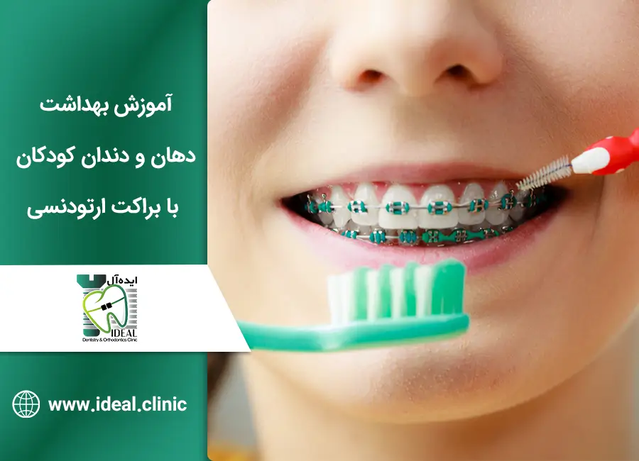 آموزش بهداشت کودکان با براکت