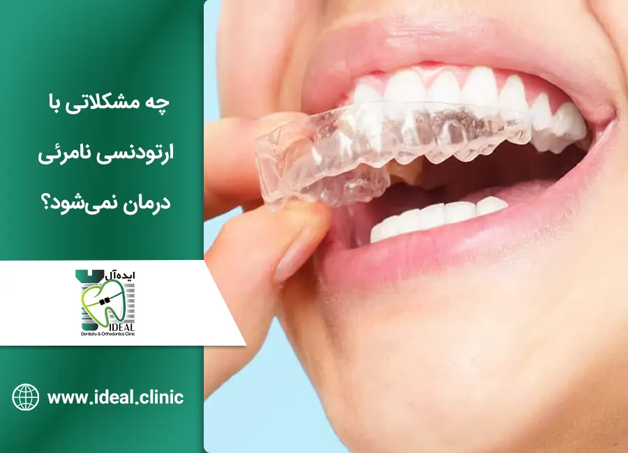 چه مشکلاتی با ارتودنسی نامرئی درمان نمی‌شود